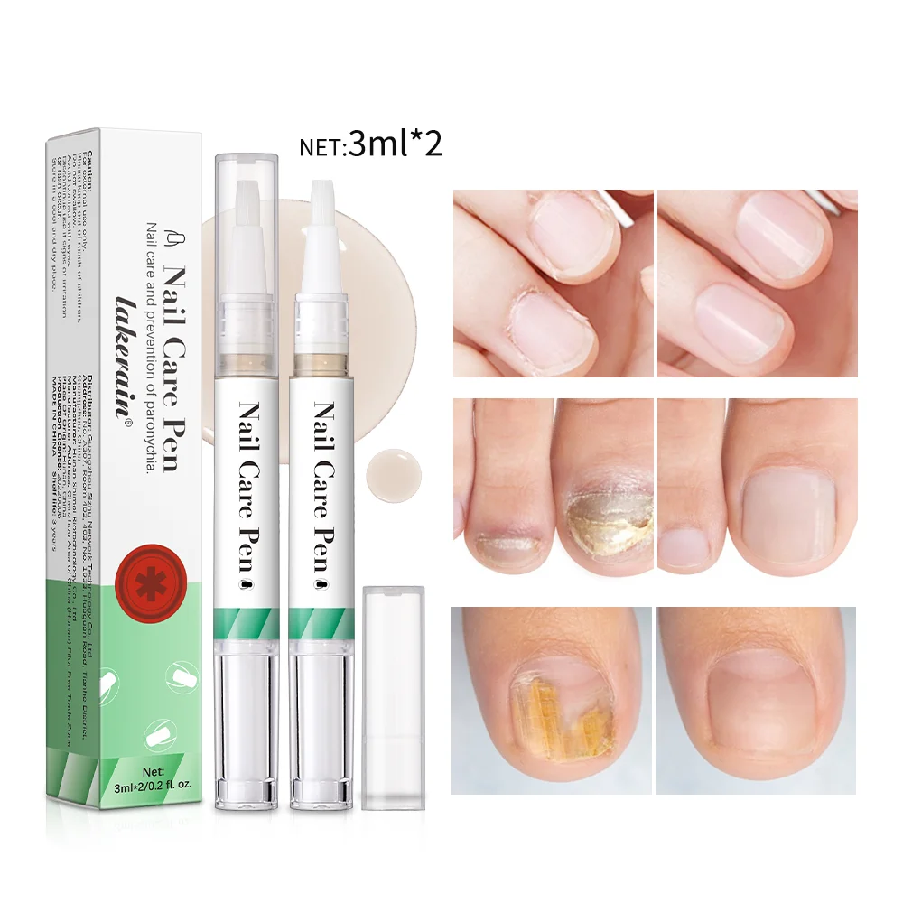 Pluma de aceite para cutículas, cuidado de uñas, manicura Natural, pluma de nutrición portátil para restaurar uñas fuertes y saludables