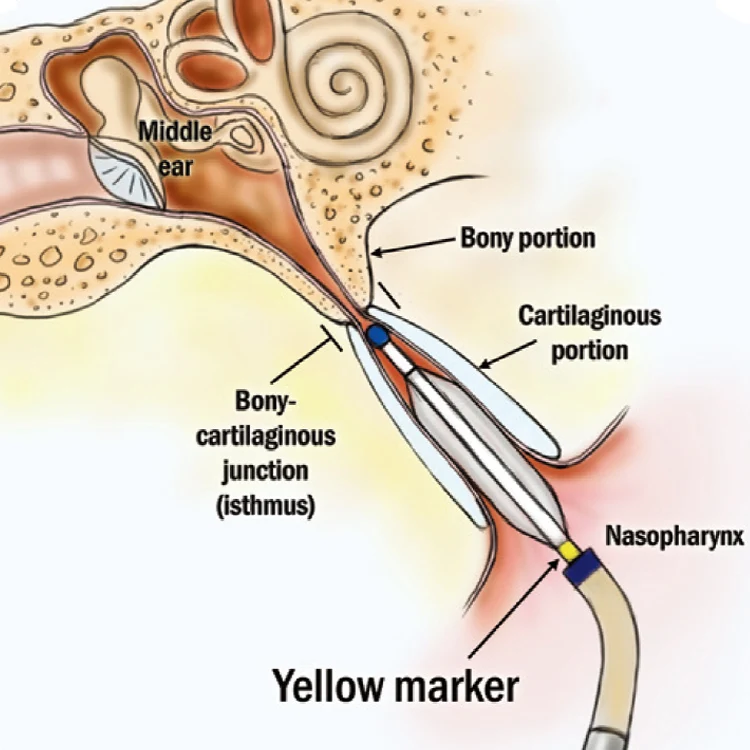 High Quality Eustac…