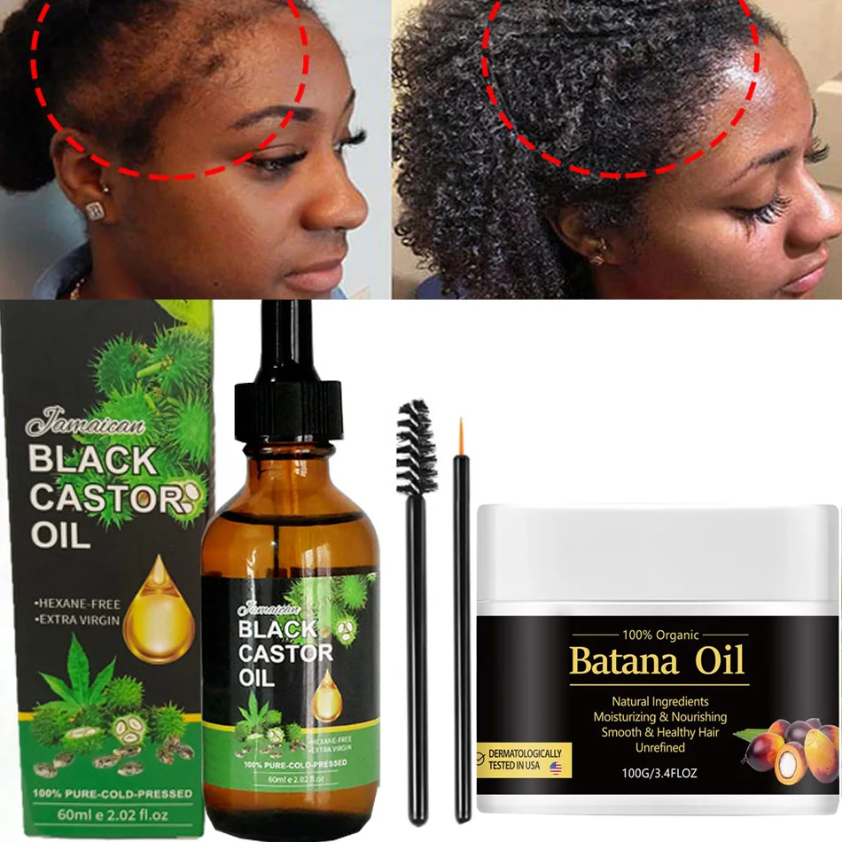 

Natural Batana Oil For Hair Growth Butter Hair Mask From Honduras Hair Loss Treatment And Black Castor Oil For Black Men & Women