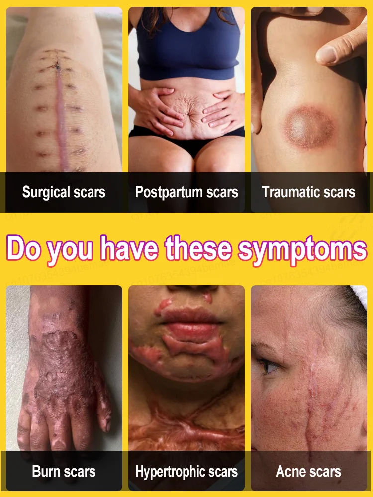 Faites les cicatrices qui disparaissent et a réchauffent votre confiance