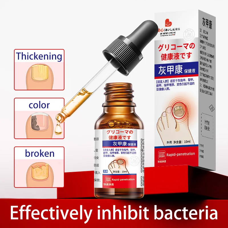 Zehennagel Nagel Pilz Behandlung Serum Fuß Reparatur Flüssigkeit Entfernung Ätherische Öle Fuß Nagel Pilz Reparatur Gel Hand Fuß Pflege
