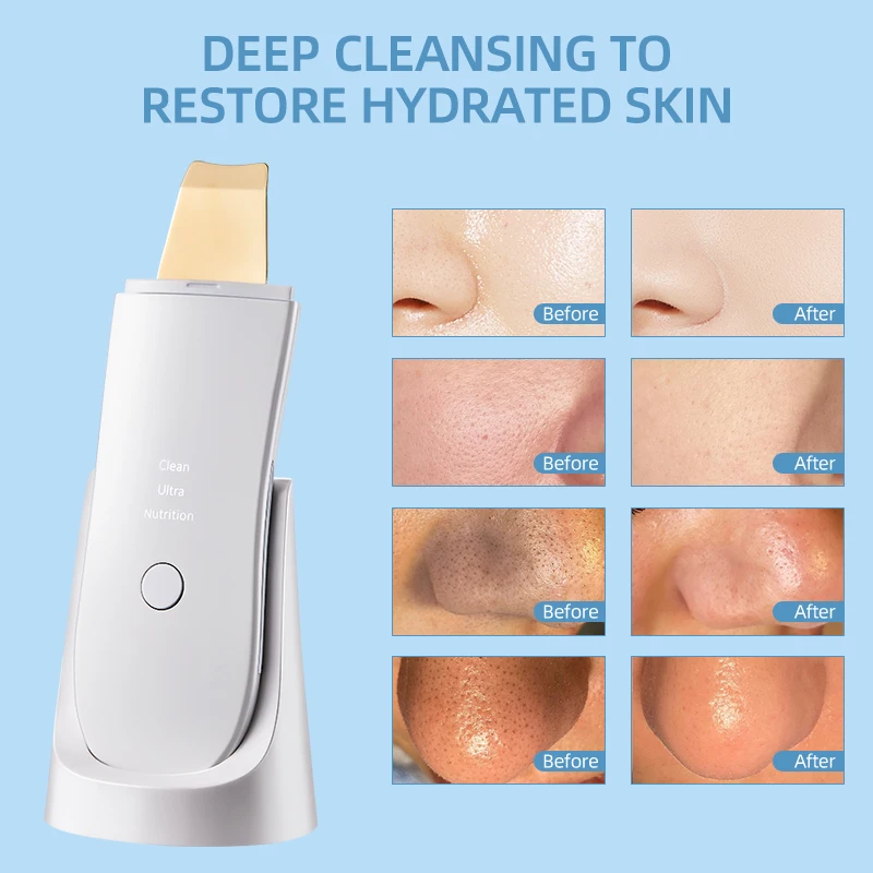 Ultrasonic Facial Cleaner Device EMS Skin Scrubber Blackhead Remove Pores Deep Cleaning Peeling Sholve Skin Care Face Lifting