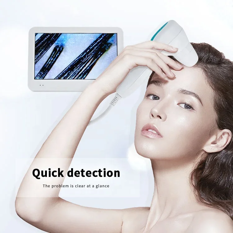 Hair And Scalp Scanner Scalp Skin Analyser Hair Scalp Detector Hair Analyzer Equipment