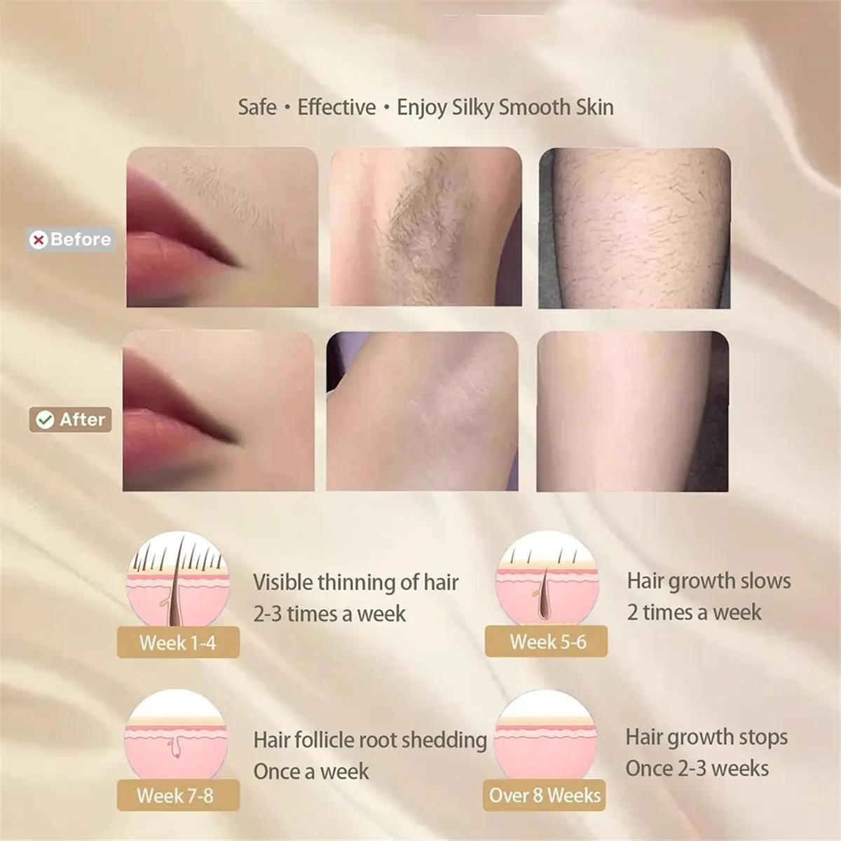 (AD11] Hair Removal Device, 5 Levels At-Home Removal Device Painless Hair Remover on Armpits Back Legs Arms Face US Plug