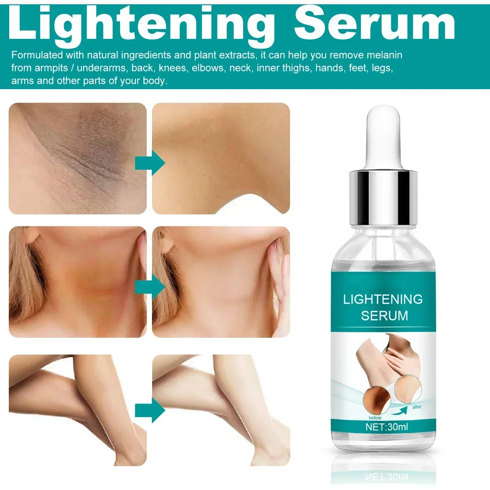 STkin Whitening Serum Private Parts Underarm Bleaching Serum Whiten Butt Knee Brighten Inner Thigh Arm Body Remove Dark Melanin
