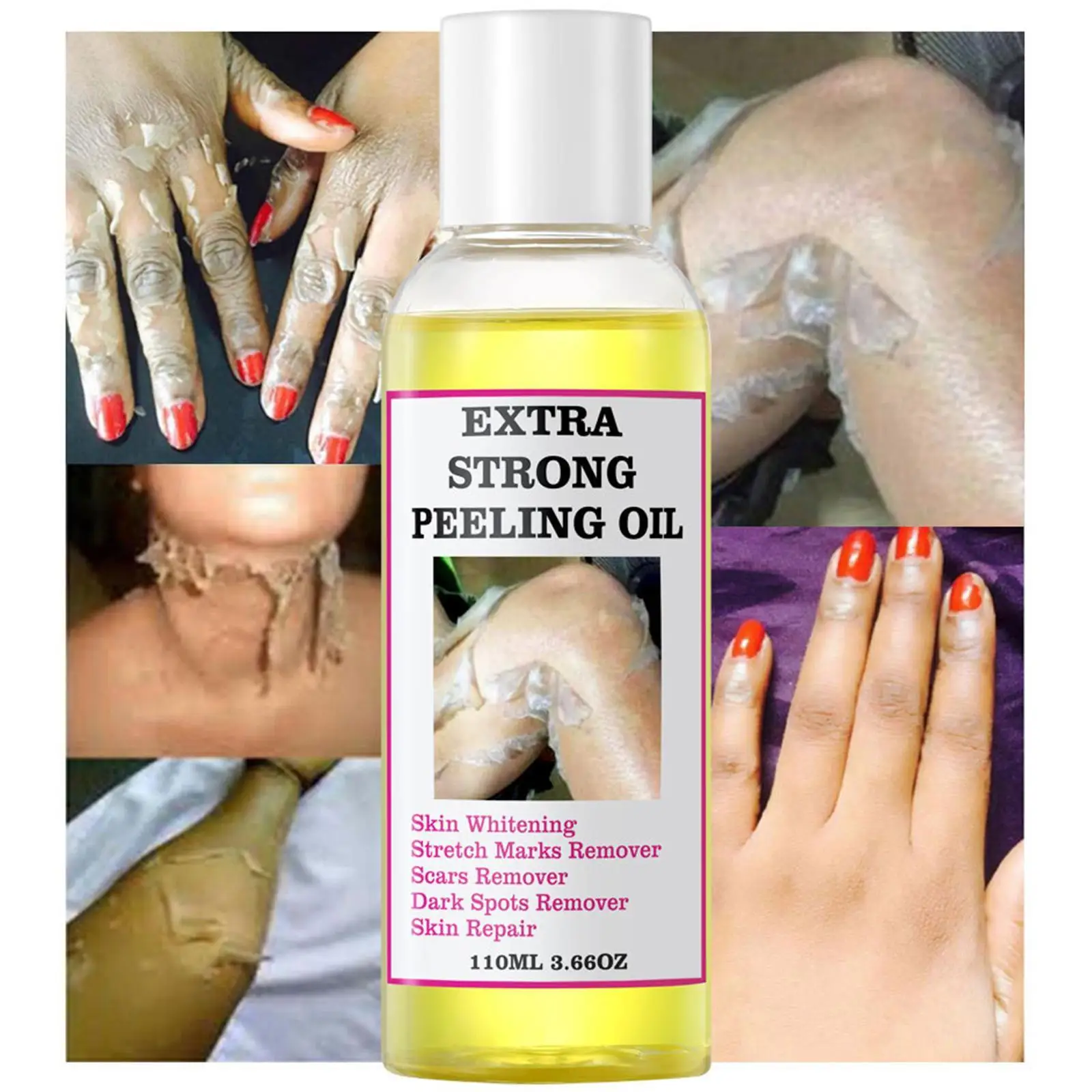 Peeling Oil For Dark Skin Super Strength Yellow Peeling Oil Strong Peeling Oil For Skin Brightening Moisturizing Removes Dead