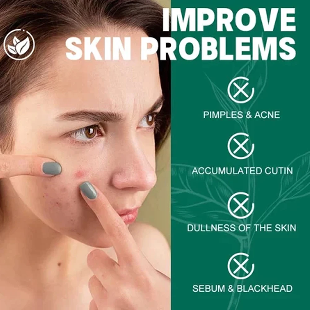 مجموعة SOME BY MI AHA-BHA-PHA لمدة 30 يومًا معجزة لحب الشباب (تونر، كريمي، رغوة حب الشباب) مناسبة للبشرة الحساسة لحب الشباب الدهنية