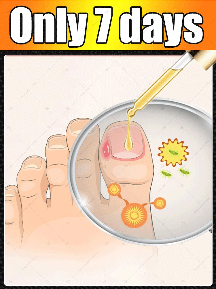 

2025 Toenail Fungus Patch Waterproof Nail Repair Patches Nail Ingrown Correction Sticker Discolored Damaged Nail Foot Care Tool
