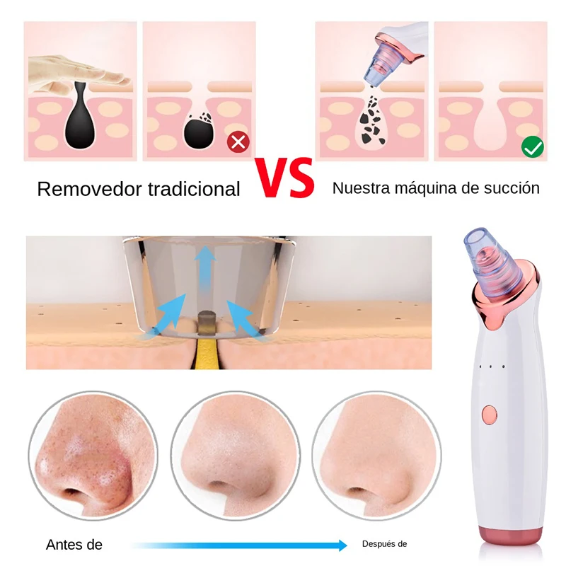 مزيل الرؤوس السوداء المحمول، منظف المسام للرجال والنساء، هو أداة فعالة لتجميل البشرة لإزالة الرؤوس السوداء