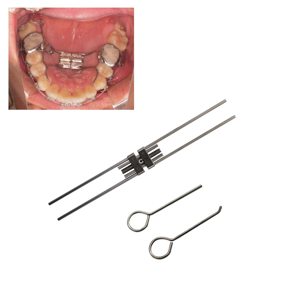 Ortodoncja stomatologiczna ze stali nierdzewnej śruba rozprężająca szybki ekspander podniebienny ramka zęby materiał z drutu łukowego