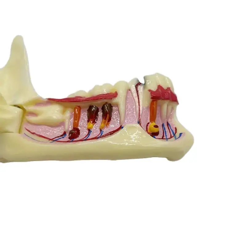 Мстительная стоматологическая обучающая модель, структура зубов, разложение, демонстрация стоматологии, инструменты для обучения студентов M4014