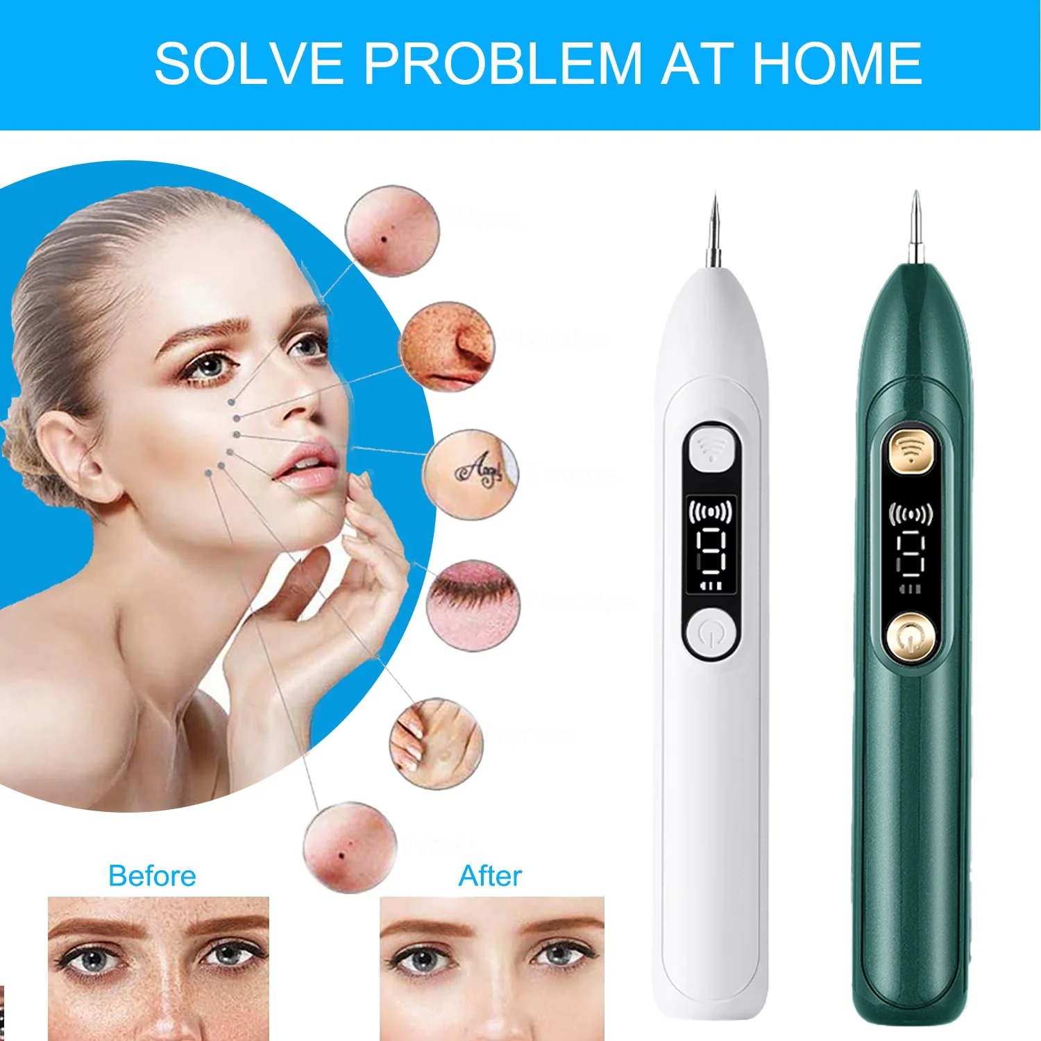 

9-gear Mole Pen Blue Light Repair Electric Beauty Spot Pen Beauty Salon Special Remove Mole Fat Grain Warts USB Charging