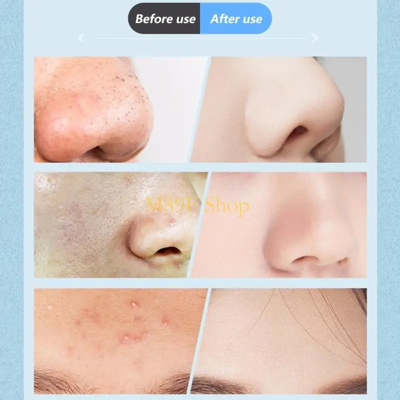 M89F مزيل مسام الوجه القابل لإعادة الشحن ومزيل الرؤوس السوداء 3 مستويات وضع الشفط مقاوم للماء لتنظيف عميق وعرض واضح #3