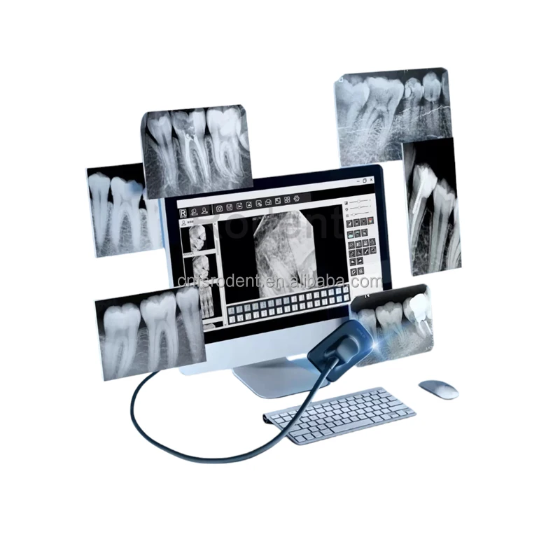 Manufacturer Price Tooth X ray Sensor Equipment Powerful Imaging Management Software Tooth Rvg Sensor