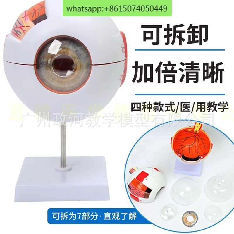 Human eyeball model, 6-fold enlarged eyeball model, facial features, eye structure, anatomy, ophthalmology teaching model