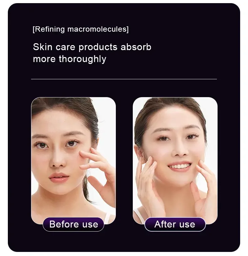 Dispositivo facial de microagulha de radiofrequência, terapia de íon de luz led, haste de tratamento de levantamento de pele do pescoço, ferramenta de aperto de rugas