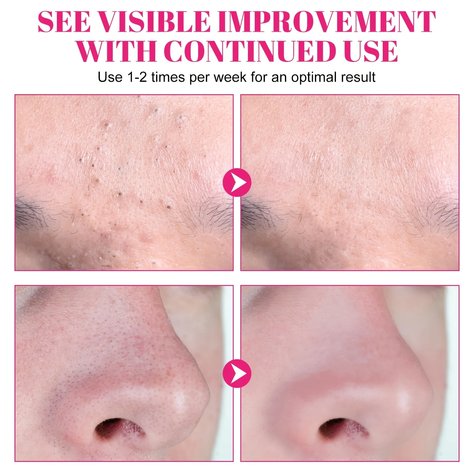 15 قطعة من رقع الأنف: ينظف ويعيد البشرة بعمق على أنفك، وتفتح المسام، وتركيبة لطيفة، والتحكم في الزيت طويل الأمد