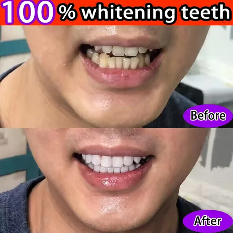 5 Days Teeth Whitening Toothpaste Powder Remove Plaque Stains Dental Calculus Oral Hygiene Cleaning Fresh Bad Breath Tooth Care