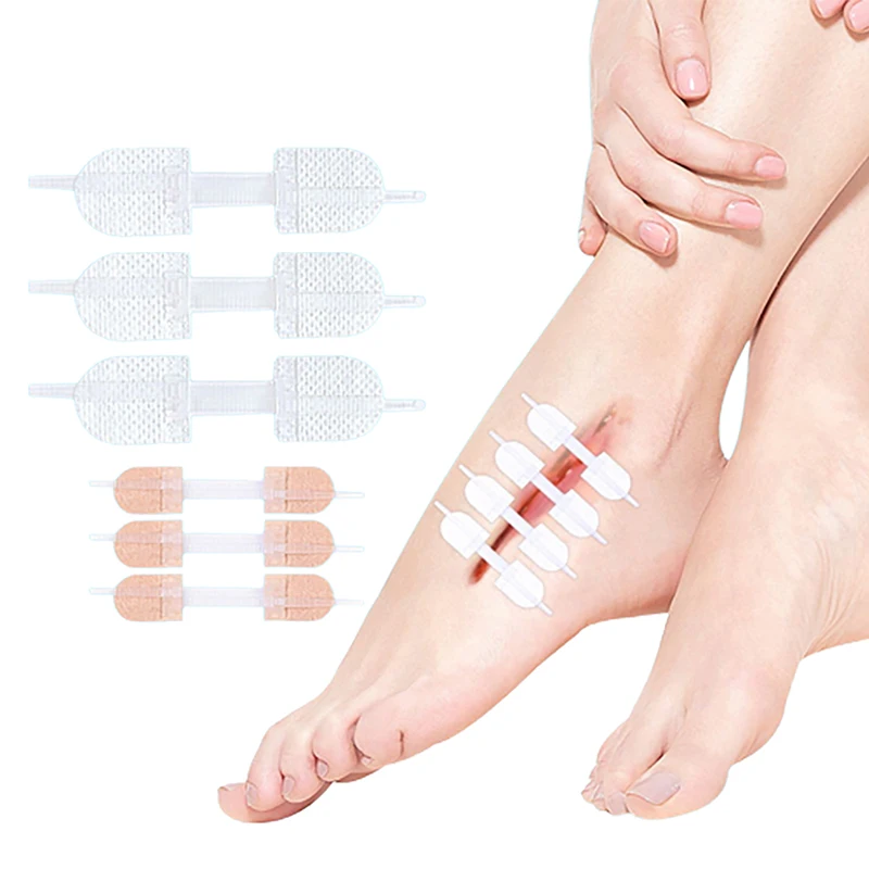 

3 шт., завязка на молнии, пластырь для закрытия ран, кровоостанавливающий пластырь, быстрый шовный пластырь на молнии, портативный уличный уход за кожей