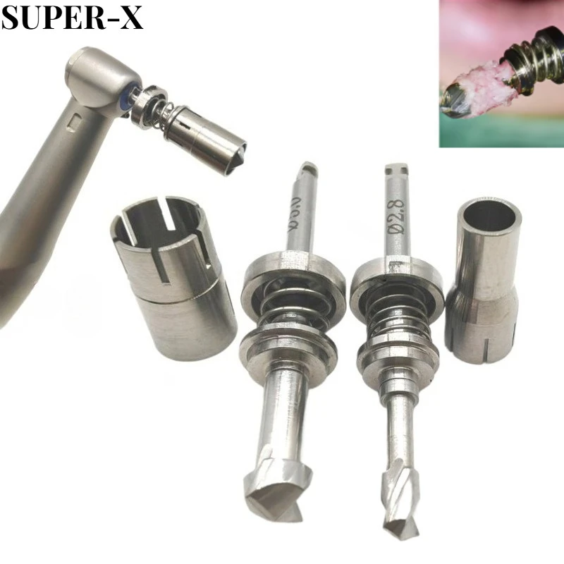 

1PCS Dental GBR Self-Grinding Spring Bone Harvest Drill with Sleeve JeilSpring Bone Drill No Loss of Bone Powder Dental Tools