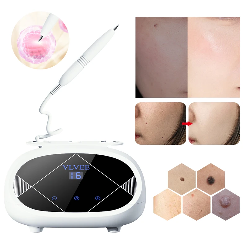 

VLVEE 16 Levels LCD Facial Mole Removal Beauty Device Remover warts Dark Spot Nevus Skin Tag Laser Plasma Pen Home Use