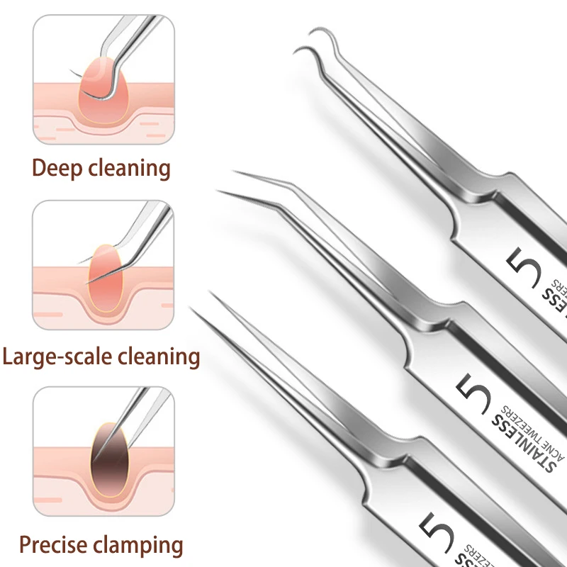 美容院の黒ずみやニキビを除去するためのプロフェッショナルピンセット、黒ずみクリーニングツール、フェイシャルスキンケアツール2/3個