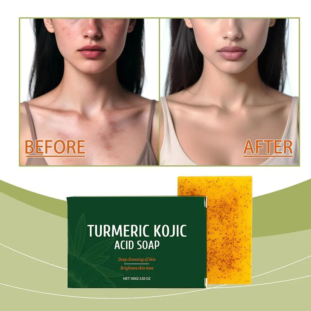 100g Turmeric Kojic Acid Soap Brightening Moisturizing Exfoliating Fading Body Pigmentation Handmade Shower and Facial Soap
