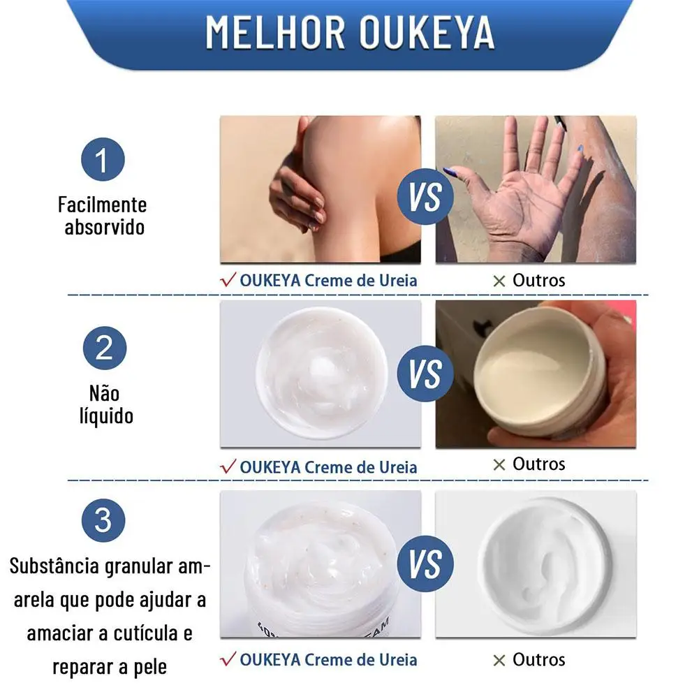 Urea Cream 40% Moisturizing Anti-Dry Hand Foot Cream Soften Calluses Remove Dead Skin Cracked Heel Repair Gentle Non-Greasy view 4