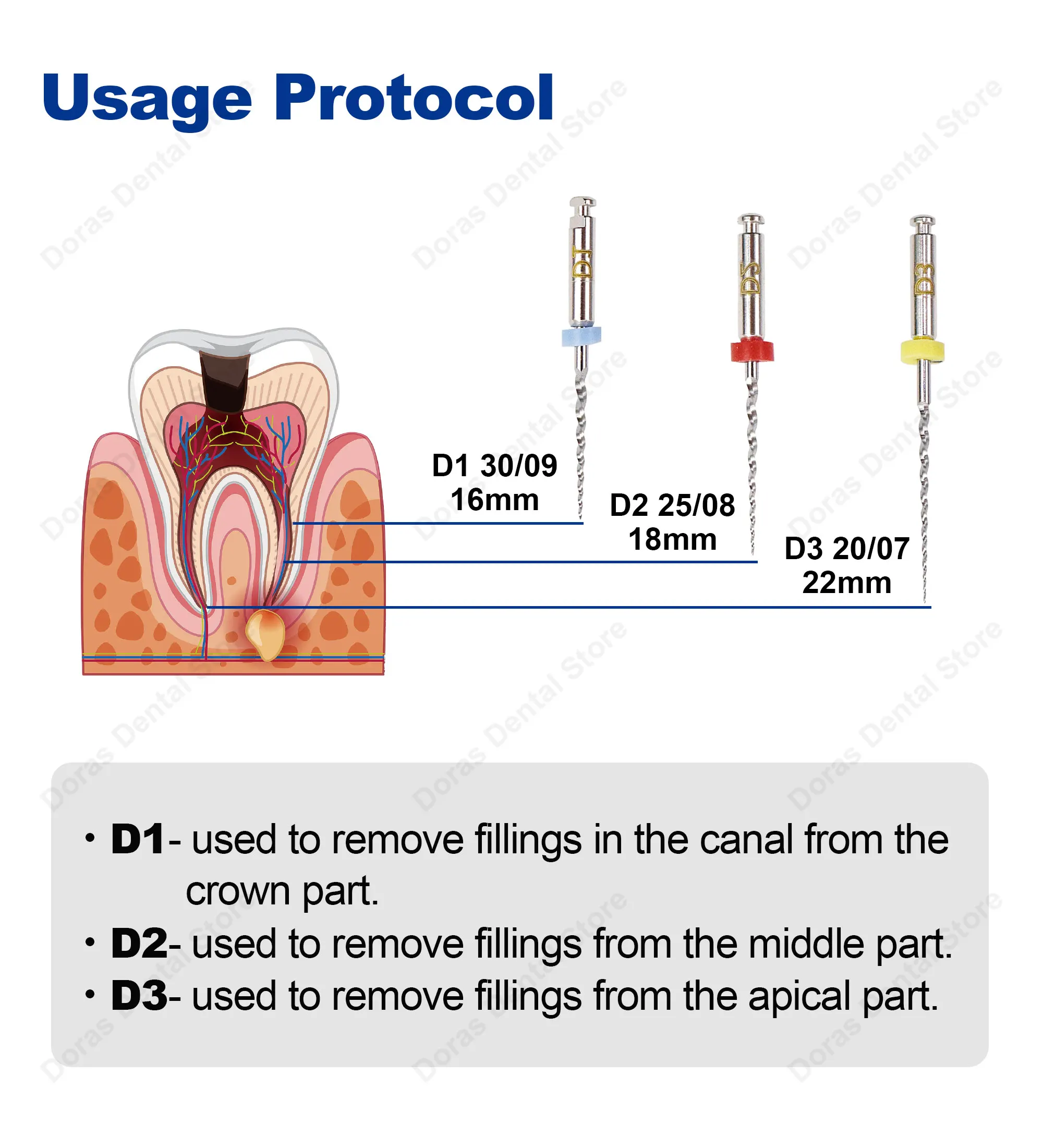 Glin Dental Super D Retreatment Files For Root Canal Treatment Endodontic Files Rotary Files D1-D3 Dentistry Instrument