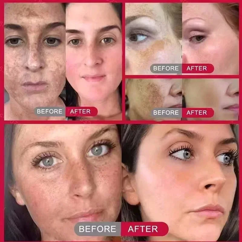 Thumbnail 2 - #64 Best Face Care to Buy In 2026