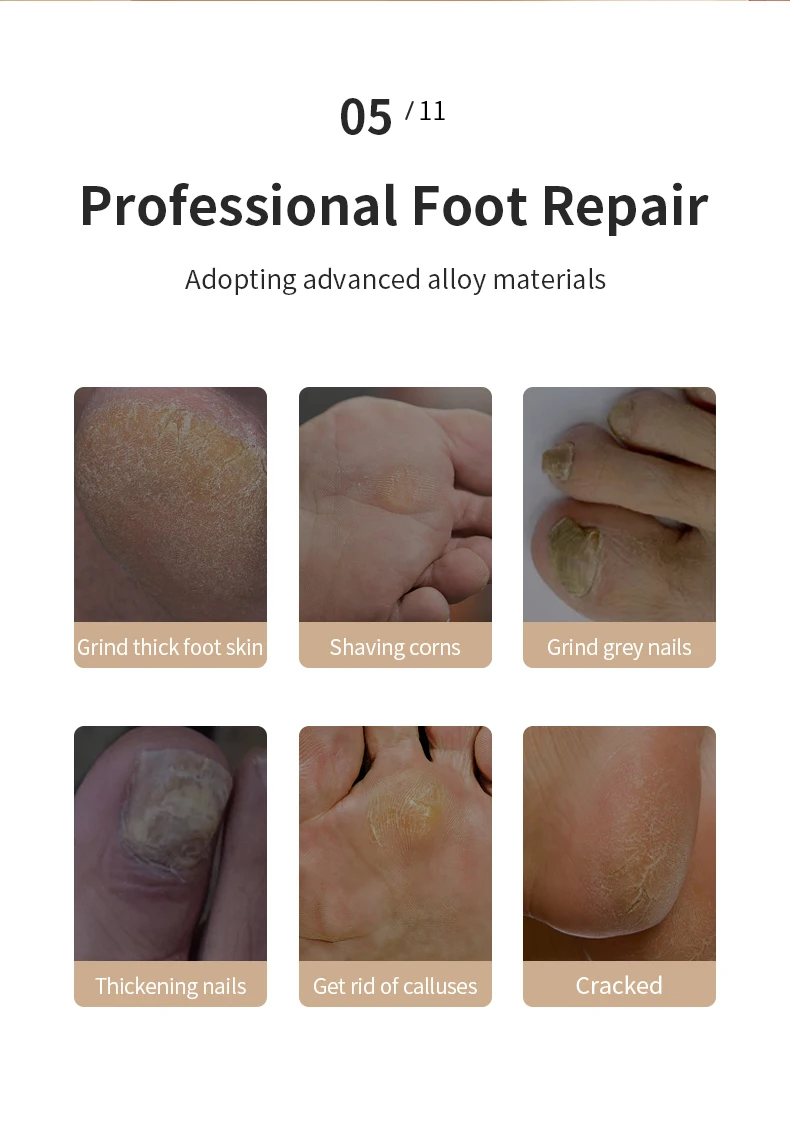Electric Foot File Waterproof Callus Remover Rechargeable Grinder_voghion.com