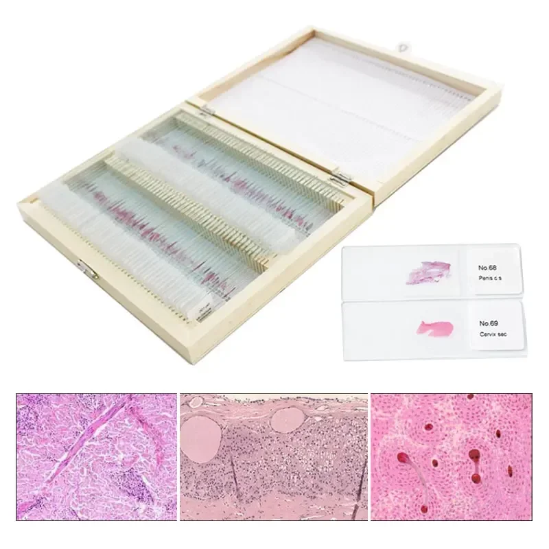 100PCS Human Histology and Embryology Prepared Physiological Slices Specimen Scetion Microscope Slides for Medical Study