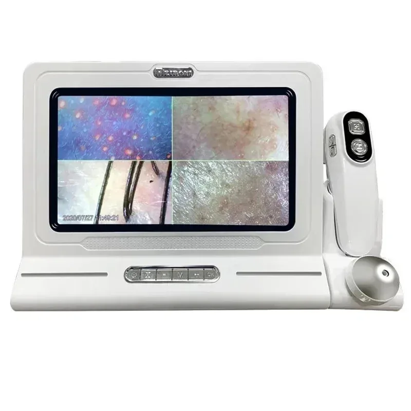 11 Inch LCD Digitale Microscoop Vergrootglas Huid- en Haaranalysator Detector voor Mee-eter Follikel Hoofdhuid 50X-200X Zoom