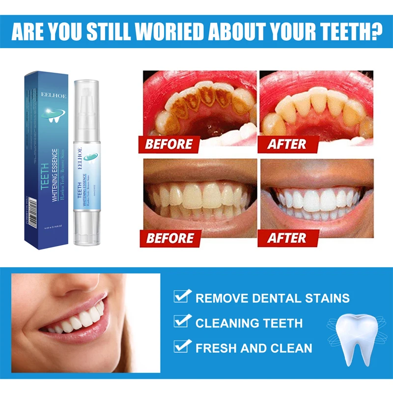 V34 Teeth Whitening Pen Mousse Toothpaste Remove Teeth Bleaching Plaque Stains Oral Hygiene Cleaning Dental Tools Fresh Breath