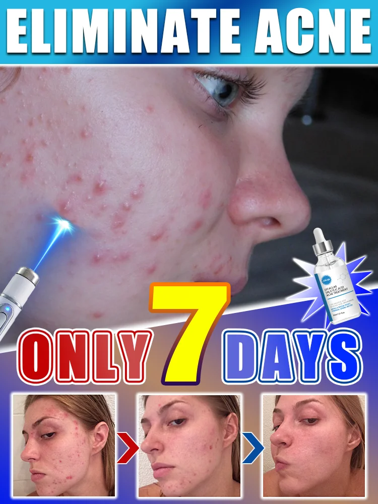 

Hot selling nano laser for facial acne