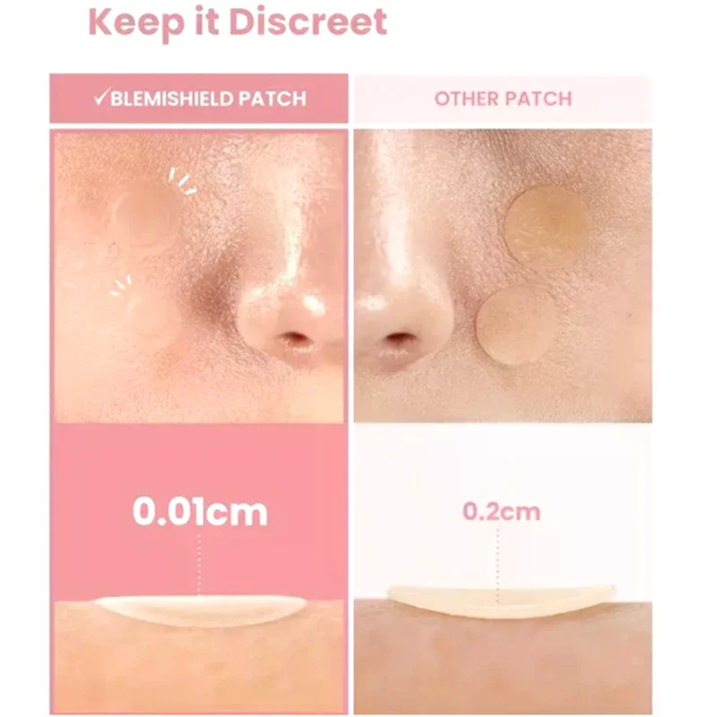 360 قطعة غير مرئية على شكل قلب ونجمة الوجه للعناية بالبشرة حب الشباب بثرة التصحيح شفاء المهنية