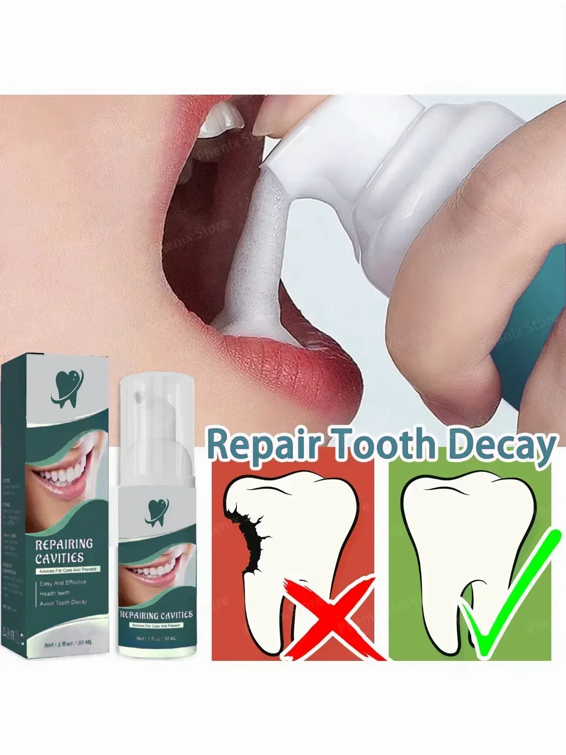 Dental Caries Repair Serum Prevent Tooth Decay Protect Teeth Remove Plaque Oral Cleaning Natural Herbal Extract 30ml