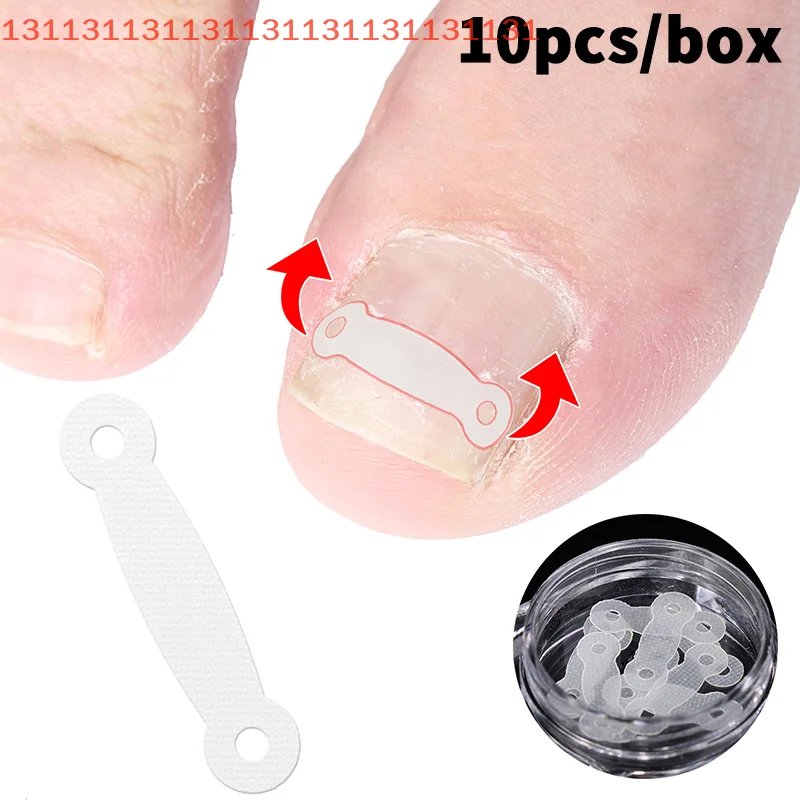 10개입 탄력 패치 스티커 교정 클립 브레이스 페디큐어 도구 내성발톱 치료 내성발톱 교정 도구