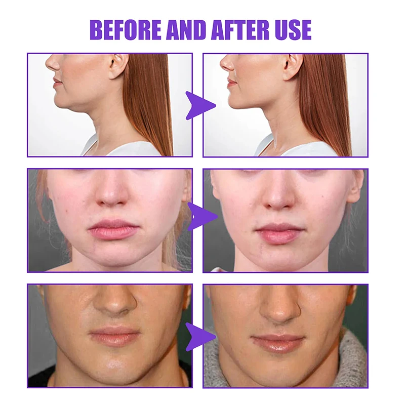 V Shape Slimming Cream Firming Face-lift Remove Masseter Muscle Double Chin Tighten Mandibular Fat Burning Cream Fade Neck Lines