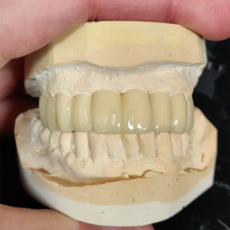 Cad Cam Monolayer discos Pmma, bloques acrílicos, espesor 16-20mm para dentadura Dental, 98mm