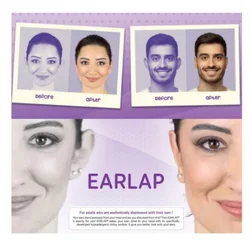 Ear Corrective Beauty Tapes Earlap Cosmetics Hearing Concealer Instant Effect Adhesive System Protruding Trend Easy to Carry Fashion Spring Summer Autumn Winter 2022 Fast Delivery Health Hygiene On Sale Season