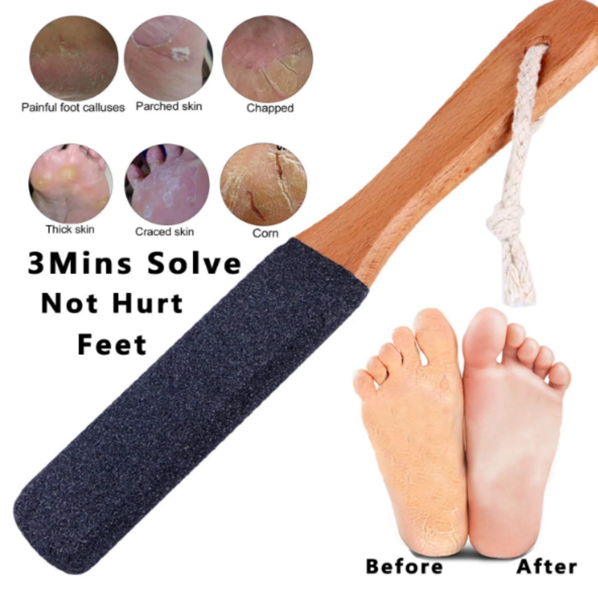 Foot File Callus Remover Foot Scrubber | Pedicure Foot Rasp Removes Cracked Heels|Dead Skin,Corn,Hard Skin,Pumice Stone for Feet