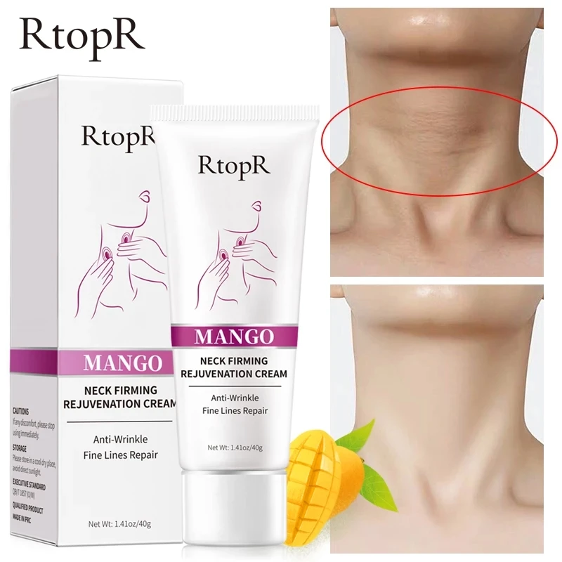 RtopR Mango Neck Cream Anti Wrinkle Remove Neck Mask Whitening Firming for Neck Masks Skin Care Delicate and Slippery