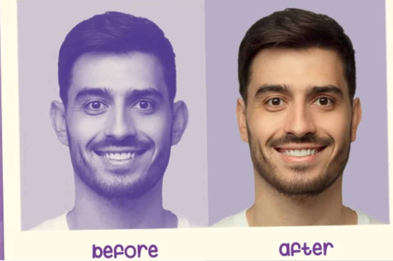 Corrector de oreja sobresaliente o prominente, cintas adhesivas, uso fácil y efectivo, inofensivo para la piel velon velas limpiador de oídos (nuevo