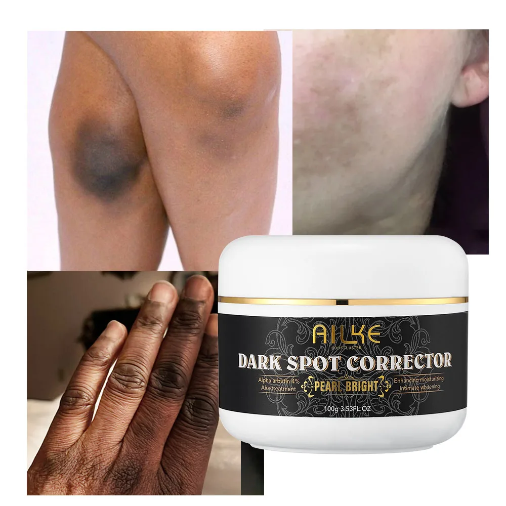 AILKE Organic Dark Spot Corrector, Knuckle Whitening Cream, Sun Spots, Age Spot Remover, Underarm Brightening Body Lotion 100ML