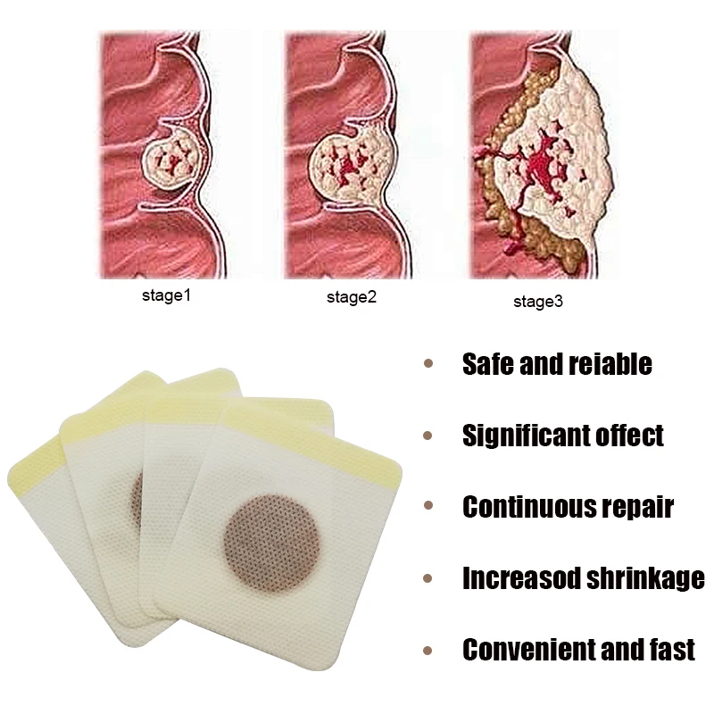 Good Material Hemorrhoid Stick Anti Hemorrhoid Anorectal Bleeding Swelling And Itching Paste Body Health Care