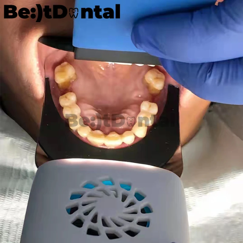 Led Electronic Mirror Defog Dental Oral Photography Mirrors Defog Occlusal Ortho Led Defog Mirror