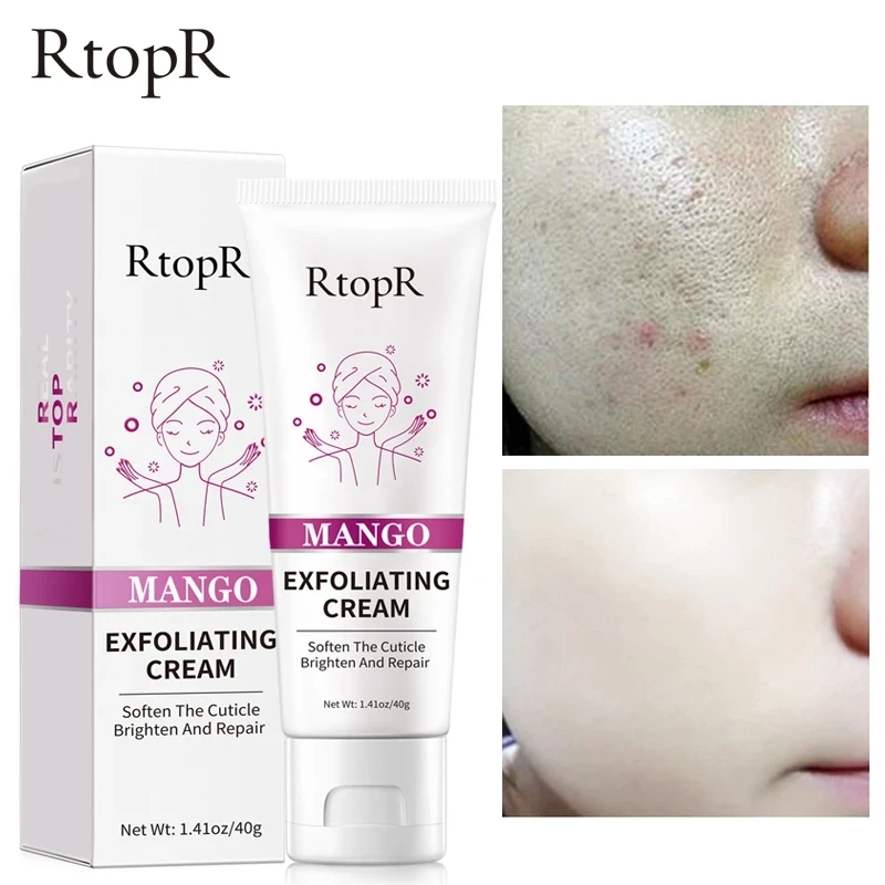 Skin Care Face Exfoliating Cream Whitening Moisturizer Repair Facial Scrub Cleaner Acne Blackhead Treatment Remove Face Cream