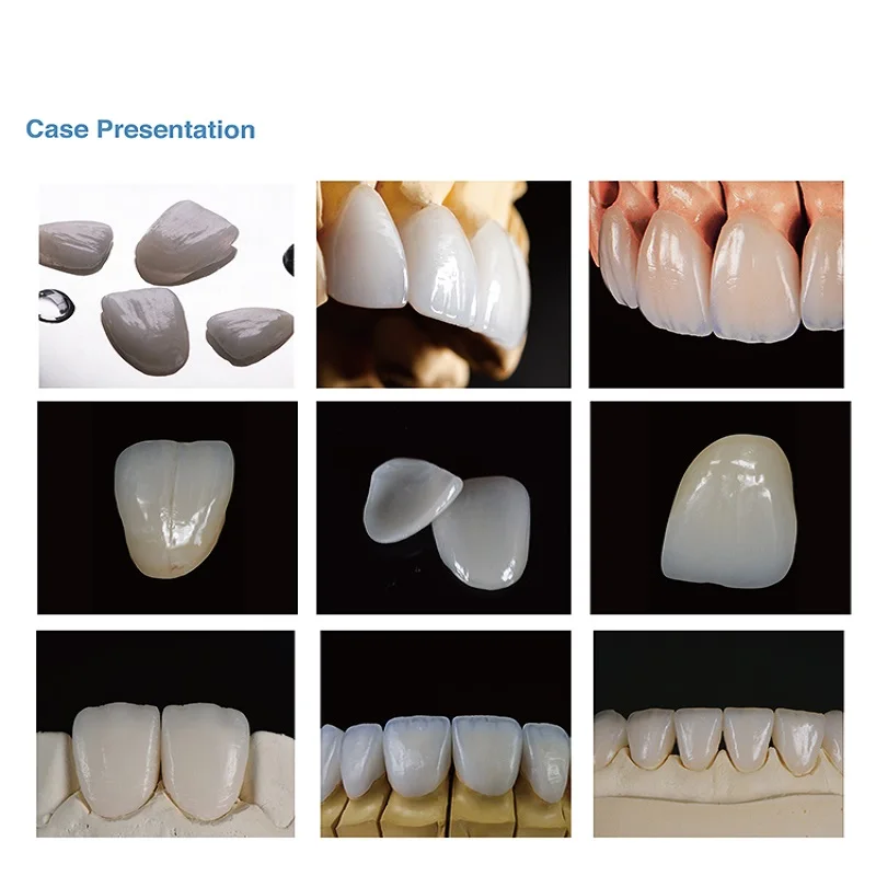 

Yucera High Translucent Dental Lithium Dislicate Blocks Glass Ceramic Block for Dental Lithium Dislicate C14-LT