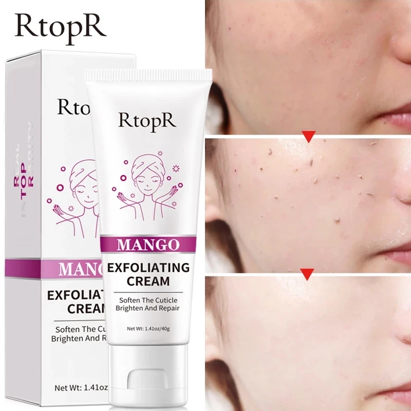 Skin Care Face Exfoliating Cream Whitening Moisturizer Repair Facial Scrub Cleaner Acne Blackhead Treatment Remove Face Cream